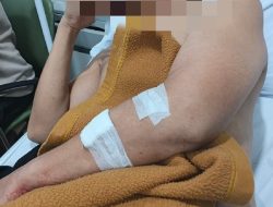 Gesekan Antar-Pengunjung Berujung Penyerangan, Dua Security Cafe Andrews Party Terluka